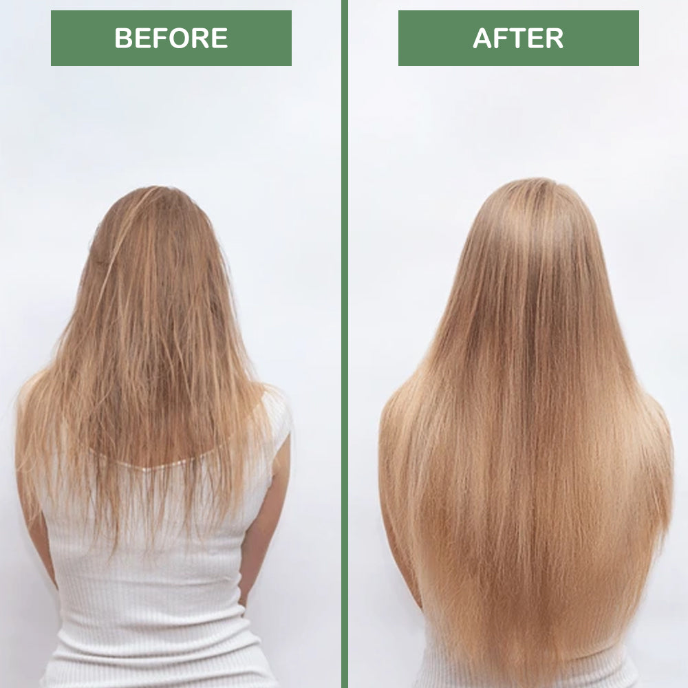 Biotin Hair Loss Treatment Serum