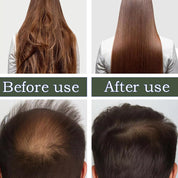 Batana Oil for Hair Loss Treatment